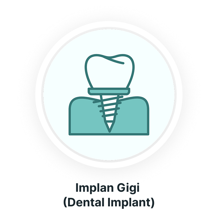 Implan gigi