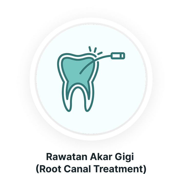 Rawatan akar gigi